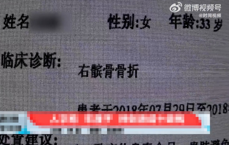 女事主被诊断为右髌骨骨折。 微博