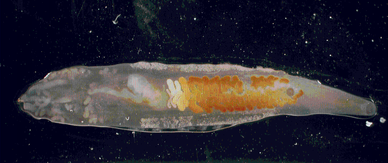 顯微鏡下的中華肝吸蟲 圖片來源：食安中心網站