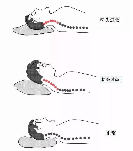 睡觉需要适合高度的枕头。